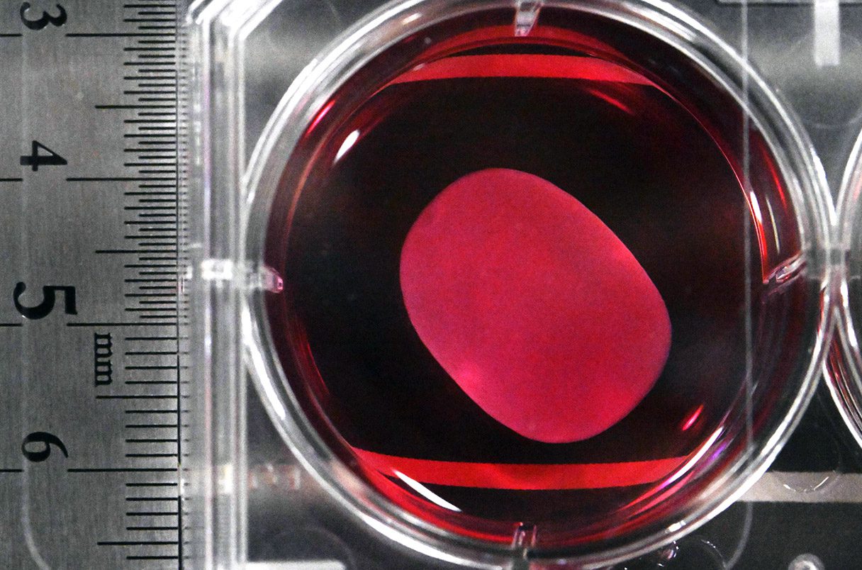 The Dawn of Regenerative Medicine: How Laboratory Grown Cells Are Healing the Human Brain